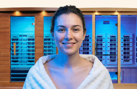 Blue Light Chromotherapy in Saunas: Can You Target Acne Bacteria While You Sweat?